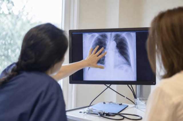 A clinician reviewing a patient's chest imaging on a monitor in a quiet exam room