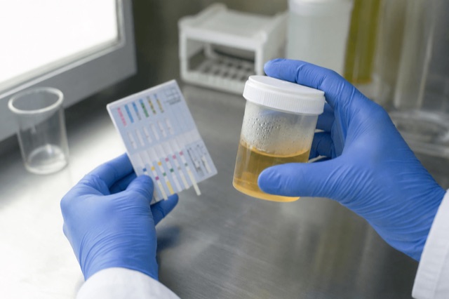 A lab technician's gloved hands holding a labeled urine sample cup beside a test panel in a clinical lab